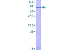 SDS-PAGE (SDS) image for Keratin 4 (KRT4) (AA 1-534) protein (GST tag) (ABIN1309007)