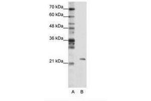 Image no. 1 for anti-Mitochondrial rRNA Methyltransferase 1 Homolog (MRM1) (AA 25-74) antibody (ABIN203015) (MRM1 anticorps  (AA 25-74))