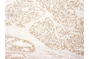 Immunohistochemistry (IHC) image for anti-Splicing Factor, Arginine/serine-Rich 14 (SFRS14) (AA 725-775) antibody (ABIN7449025) (SFRS14 anticorps  (AA 725-775))