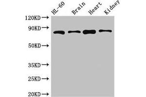 Western Blot Positive WB detected in: HL60 whole cell lysate, Mouse brain tissue, Mouse heart tissue, Mouse kidney tissue All lanes: ABCB9 antibody at 5 μg/mL Secondary Goat polyclonal to rabbit IgG at 1/50000 dilution Predicted band size: 85, 80, 67, 76, 78 kDa Observed band size: 85 kDa (ABCB9 anticorps  (AA 630-766))