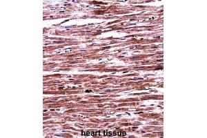 Immunohistochemistry (IHC) image for anti-Ring Finger Protein 19A (RNF19A) antibody (ABIN2997832)