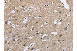 The image on the left is immunohistochemistry of paraffin-embedded Human brain tissue using ABIN7128713(CAB39L Antibody) at dilution 1/40, on the right is treated with fusion protein. (CAB39L anticorps)