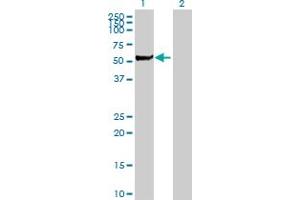 Western Blot analysis of STK3 expression in transfected 293T cell line by STK3 MaxPab polyclonal antibody. (STK3 anticorps  (AA 1-491))