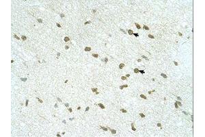 Image no. 1 for anti-Ring Finger Protein 168 (RNF168) (AA 401-450) antibody (ABIN6739167)