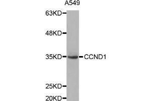Western blot analysis of extracts of A549 cell lines, using CCND1 antibody. (Cyclin D1 anticorps)