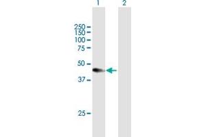 Western Blot analysis of CXADR expression in transfected 293T cell line by CXADR MaxPab polyclonal antibody. (Coxsackie Adenovirus Receptor anticorps  (AA 1-365))