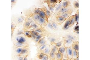 ICC analysis of gamma Catenin using anti-gamma Catenin antibody (ABIN3043864).