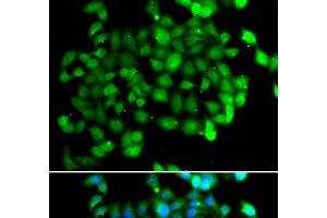 Immunofluorescence analysis of U2OS cells using APOBEC3C Polyclonal Antibody (APOBEC3C anticorps)