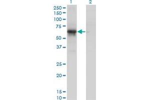 Western Blotting (WB) image for anti-Cyclin-Dependent Kinase 16 (CDK16) (AA 1-80) antibody (ABIN598860) (CDK16 anticorps  (AA 1-80))