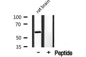 Western blot analysis of extracts from rat Brian, using Cytochrome P450 3A4/5 antibody. (Cytochrome P450 3A4, 3A5 anticorps)