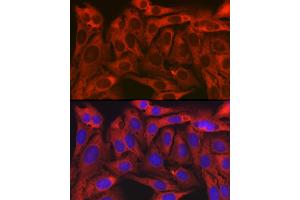 Immunofluorescence analysis of U2OS cells using TXLNA Rabbit pAb (ABIN7270744) at dilution of 1:150 (40x lens). (alpha Taxilin anticorps)
