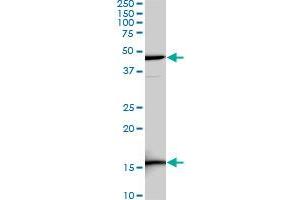 LEF1 monoclonal antibody (M03), clone 5A3.
