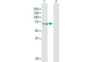 Western Blot analysis of KLF11 expression in transfected 293T cell line by KLF11 monoclonal antibody (M03), clone 10D8. (KLF11 anticorps  (AA 404-512))