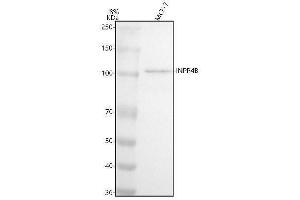 Western blot analysis of INPP4B using anti-INPP4B antibody (ABIN7605277).