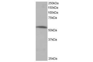 Image no. 1 for anti-Protein Phosphatase 2, Regulatory Subunit B', alpha (PPP2R5A) (C-Term) antibody (ABIN374133) (PPP2R5A anticorps  (C-Term))