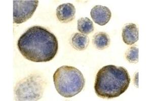 Immunohistochemistry (IHC) image for anti-Chemokine (C-X-C Motif) Receptor 4 (CXCR4) (N-Term) antibody (ABIN1031336) (CXCR4 anticorps  (N-Term))