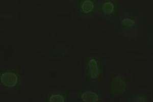 Anti-SOX17 mouse monoclonal antibody (ABIN2452673) immunofluorescent staining of HeLa cells transiently transfected by pCMV6-ENTRY SOX17 (RC220888) (SOX17 anticorps  (AA 177-414))