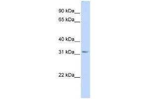 SCGN antibody used at 1 ug/ml to detect target protein. (SCGN anticorps  (Middle Region))
