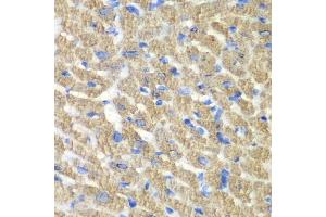 Immunohistochemistry of paraffin-embedded mouse heart using FIBP antibody  at dilution of 1:100 (40x lens). (FIBP anticorps  (AA 1-364))