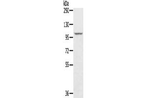 Gel: 6 % SDS-PAGE, Lysate: 40 μg, Lane: A549 cells, Primary antibody: ABIN7131212(STARD8 Antibody) at dilution 1/250, Secondary antibody: Goat anti rabbit IgG at 1/8000 dilution, Exposure time: 10 seconds (STARD8 anticorps)