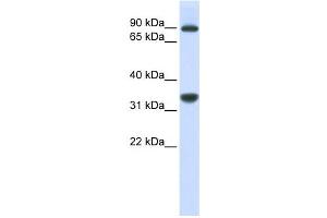 Western Blotting (WB) image for anti-Ribosomal RNA Processing 1 Homolog B (RRP1B) antibody (ABIN2458964) (RRP1B anticorps)