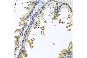 Immunohistochemistry of paraffin-embedded human prostate using NLGN4Y antibody (ABIN6133011, ABIN6144652, ABIN6144653 and ABIN6220667) at dilution of 1:100 (40x lens). (Neuroligin Y anticorps  (AA 122-256))