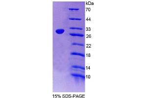 SDS-PAGE analysis of Human SGCd Protein. (SGCD Protéine)