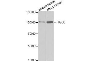 Western blot analysis of extracts of various cell lines, using ITGB5 antibody. (Integrin beta 5 anticorps  (AA 490-720))
