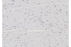 ABIN6276467 at 1/100 staining Rat heart tissue by IHC-P. (IRF4 anticorps  (C-Term))