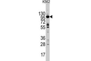Western Blotting (WB) image for anti-Myosin ID (MYO1D) antibody (ABIN3002631) (Myosin ID anticorps)