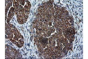 Image no. 9 for anti-Signal Sequence Receptor, alpha (SSR1) antibody (ABIN1501149)