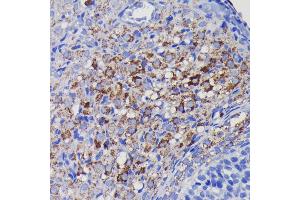 Immunohistochemistry of paraffin-embedded rat ovary using SOD2 antibody (ABIN7270638) at dilution of 1:100 (40x lens).