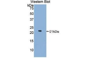 Western Blotting (WB) image for anti-Glucosidase, Alpha, Acid (GAA) (AA 595-770) antibody (ABIN1858936) (GAA anticorps  (AA 595-770))