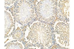 ABIN7094574 and ABIN7098623 at 1/100 staining Rat testis tissue by IHC-P.