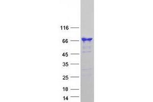 Validation with Western Blot (CAMKK1 Protein (Transcript Variant 2) (Myc-DYKDDDDK Tag))