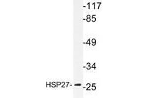 Western blot analyzes of HSP27 antibody in extracts from Jurkat cells. (HSP27 anticorps)