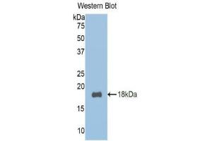 Western blot analysis of the recombinant protein. (TCF20 anticorps  (AA 392-524))