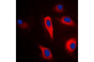 Immunofluorescent analysis of PLA2G4A staining in HeLa cells. (PLA2G4A anticorps  (Center))