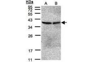 Image no. 1 for anti-Protein Phosphatase 2, Catalytic Subunit, beta Isozyme (PPP2CB) (AA 134-291) antibody (ABIN467440) (PPP2CB anticorps  (AA 134-291))