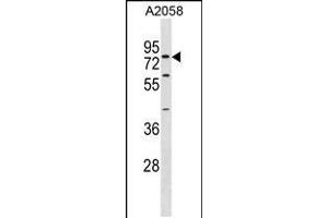 Western blot analysis in A2058 cell line lysates (35ug/lane). (SYT16 anticorps  (AA 297-325))