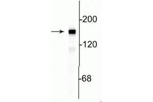 Western blot of rat cortical lysate showing specific immunolabeling of the ~145 kDa NF-M protein. (NEFM anticorps  (C-Term))