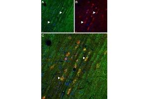 Expression of Adenosine A1 Receptor in rat medial septum - Immunohistochemical staining of rat medial septum frozen section using Anti-Adenosine A1 Receptor Antibody (ABIN7042882, ABIN7043894 and ABIN7043895).