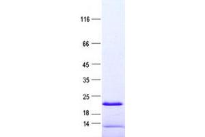 Validation with Western Blot