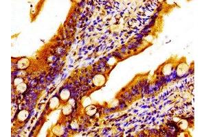 Immunohistochemistry of paraffin-embedded human small intestine tissue using ABIN7159843 at dilution of 1:100 (MTCH2 anticorps  (AA 31-131))