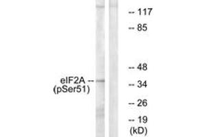 Western blot analysis of extracts from K562 cells treated with IFN-alpha 1000U/ml 18h, using eIF2 alpha (Phospho-Ser51) Antibody. (EIF2A anticorps  (pSer52))