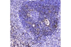IHC analysis of S100A10 using anti-S100A10 antibody .