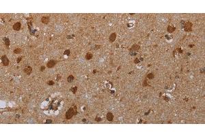 Immunohistochemistry of paraffin-embedded Human brain tissue using ATP2A1 Polyclonal Antibody at dilution 1:30