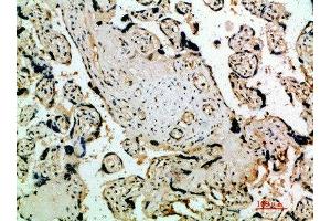 Immunohistochemical analysis of paraffin-embedded human-placenta, antibody was diluted at 1:200 (FLT4 anticorps  (AA 640-700))