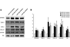 Inhibition of the miR-29 family induces ECM synthesis.