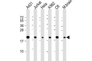All lanes : Anti-RPS10 Antibody (C-Term) at 1:2000 dilution Lane 1: A431 whole cell lysate Lane 2: Jurkat whole cell lysate Lane 3: Hela whole cell lysate Lane 4: K562 whole cell lysate Lane 5: C6 whole cell lysate Lane 6: mouse brain lysate Lysates/proteins at 20 μg per lane. (RPS10 anticorps  (AA 96-129))